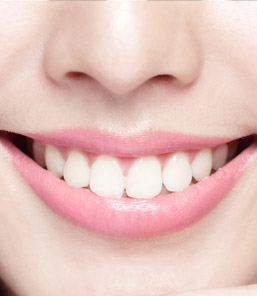 ฟอกสีฟันขาว