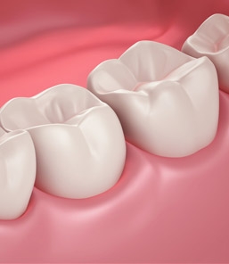 รักษาโรคปริทันต์