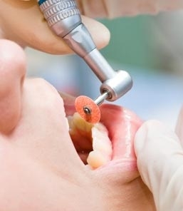 ทันตกรรมแบบทั่วไป